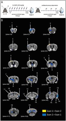 In Vivo Visualization of Active Polysynaptic Circuits With Longitudinal Manganese-Enhanced MRI (MEMRI)